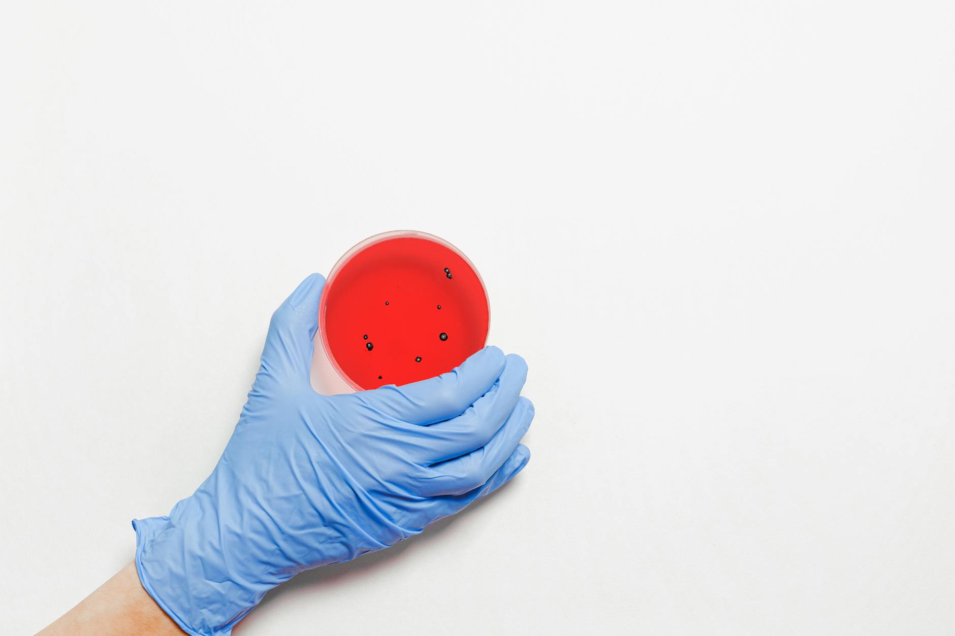 The Moldy Petri Dish That Changed Medicine Forever
